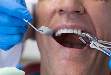 Dental Malpractice Examples